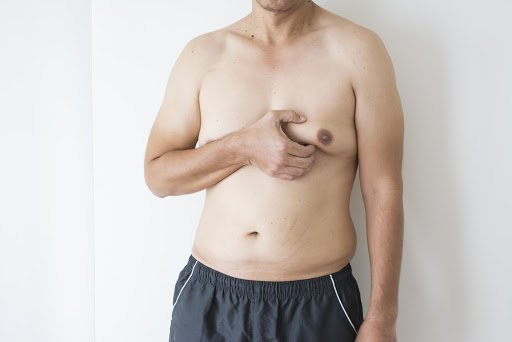 Ginecomastia – Cirurgia de mama masculina